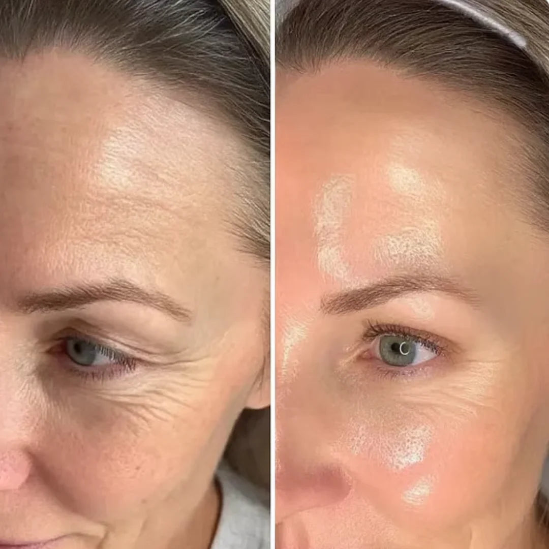 Antes e depois 2